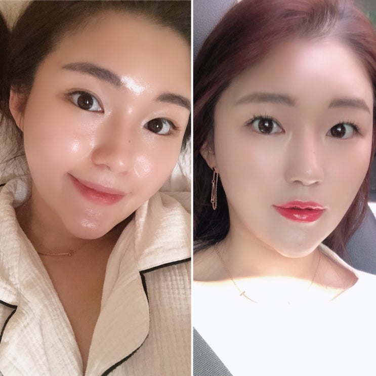  울쎄라리프는 어떤제품이예요? FAQ 안내해드려요!