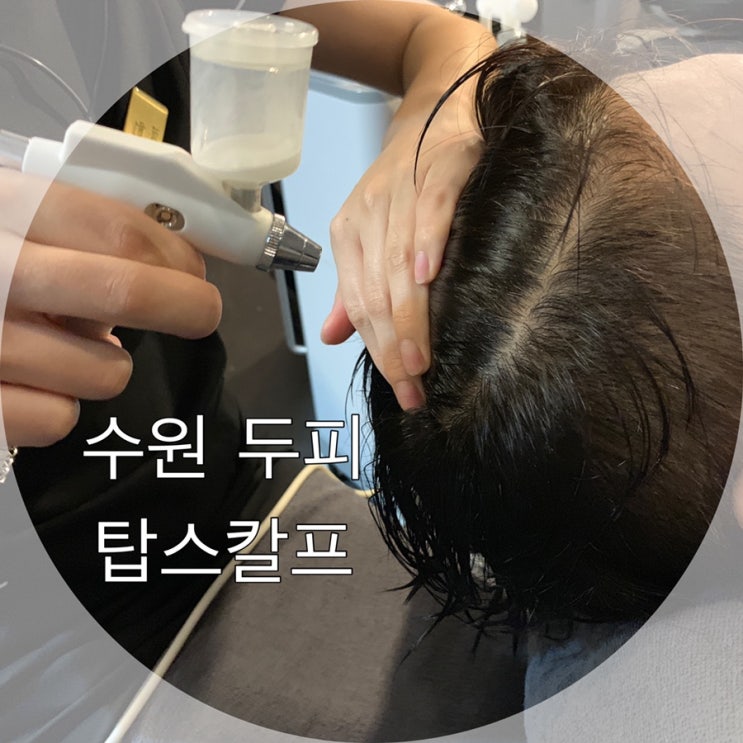  수원 두피 관리 탑스칼프에서 남자탈모상담 받고 왔어요!