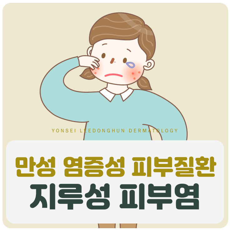  만성 염증성 피부질환, 지루성 피부염