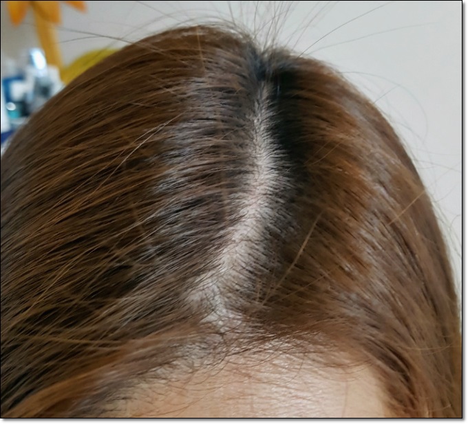  모발굵어지는법 정답을 알아요!