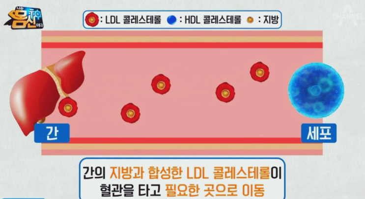  나는 몸신이다 콜레스테롤 정말 무섭네요!!