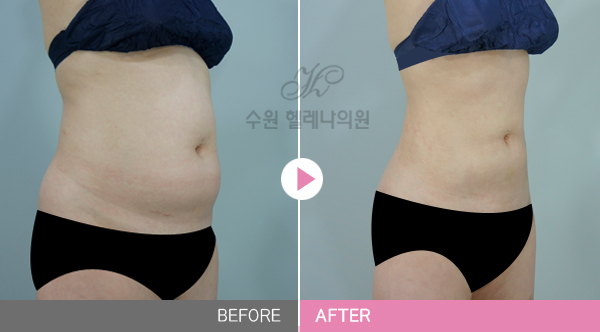  뱃살관리 용모관리 단정함이 생명