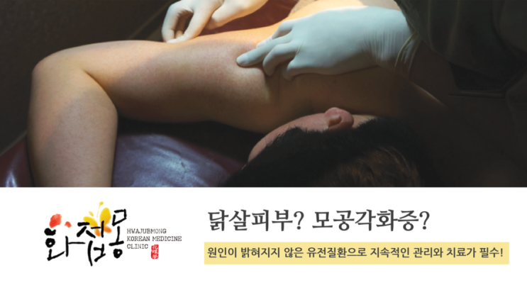  신촌모공각화증 올바른 관리로 예방하자!