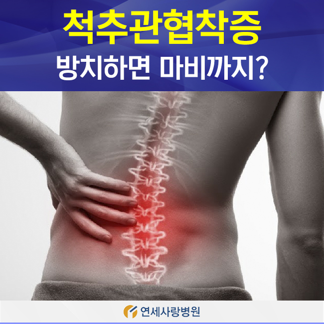  척추관협착증, 방치하면 마비까지?