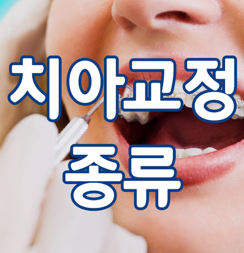  치아교정종류별 장단점에 대해 알아보자! 메탈,세라믹,클리피씨,투명,설측,콤비교정..