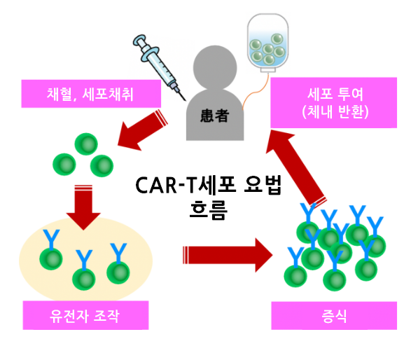  국내 최초의 유전자 변형 암 면역 요법 "CAR-T 세포 치료" 백혈병 면역치료