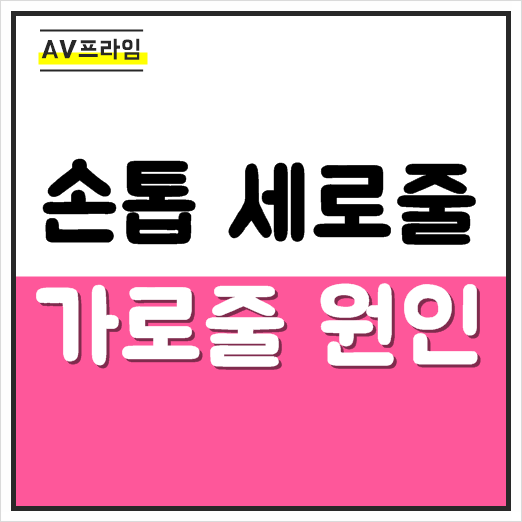 손톱 가로줄 세로줄 원인 알아보기 손톱 가로줄 세로줄 원인 알아보기