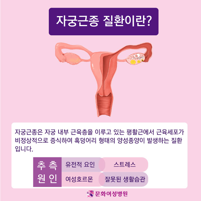 비수술 하이푸 치료, 광산구자궁근종 개선하는 방법!