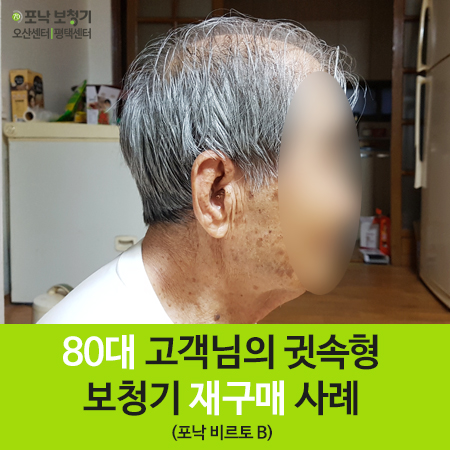  [평택 오산 포낙보청기] 80대 고객님 귓속형 보청기 재구매 사례 : CIC타입 포낙 비르토 B