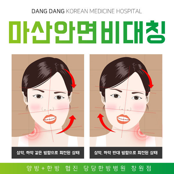  마산안면비대칭 어린이도 얼굴비대칭 증상이?