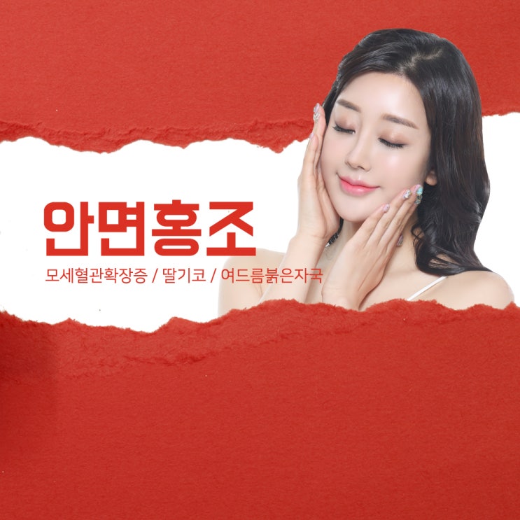  안면홍조, 딸기코(주사비),여드름붉은자국 ! 혈관병변을 치료해요