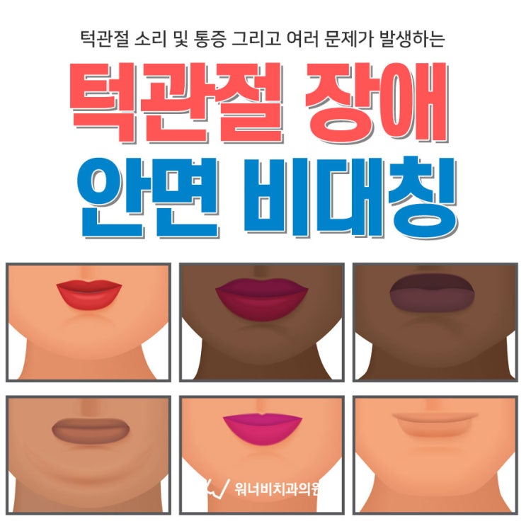  부산턱관절병원 턱관절장애의 가장 큰 문제는 안면비대칭