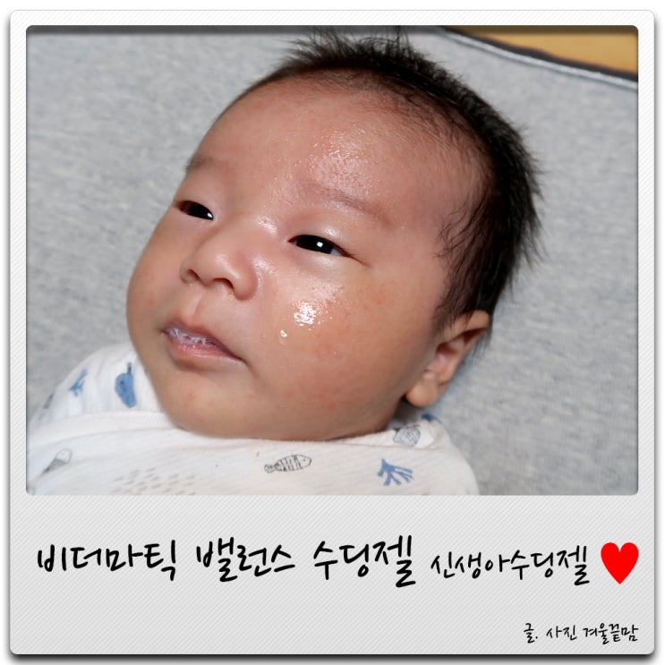 아기수딩젤 비더마틱 수딩젤로 아기태열 잡자 아기수딩젤 비더마틱 수딩젤로 아기태열 잡자