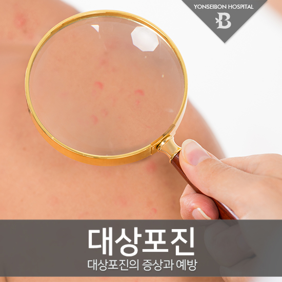  대상포진 증상을 확인하고 예방접종을 통해 대비하세요