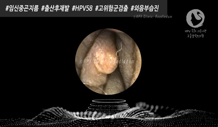  곤지름 치료비용 대체 뭐가 합리적인 걸까