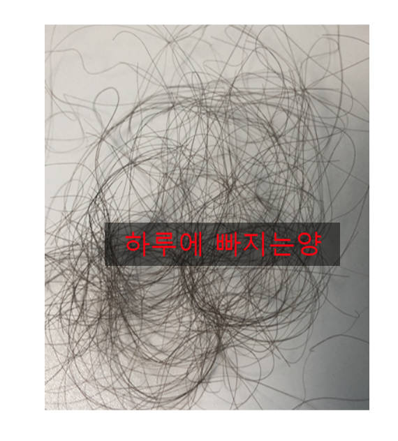  하루에 빠지는 머리카락 많을때는 저자극 샴푸 영향