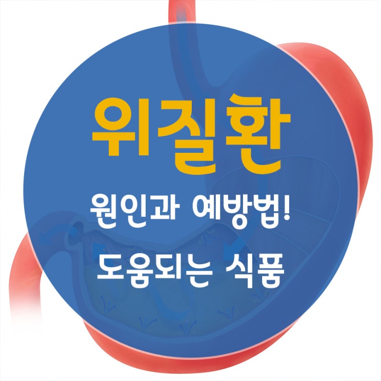  위질환 원인과 예방법!
