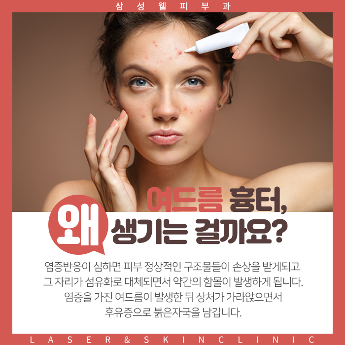  역곡역피부과 붉은 여드름자국 레이저치료로 매끈하게 만들어봐요.