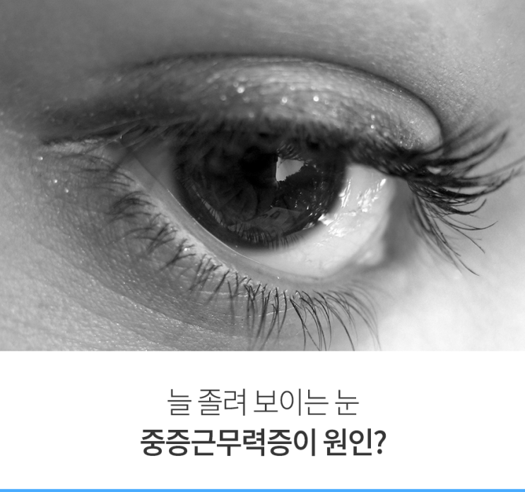  늘 졸려 보이는 눈, ‘중증근무력증’이 원인?