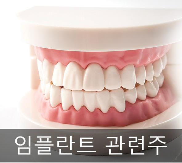  임플란트 관련주 및 대장주 리스트