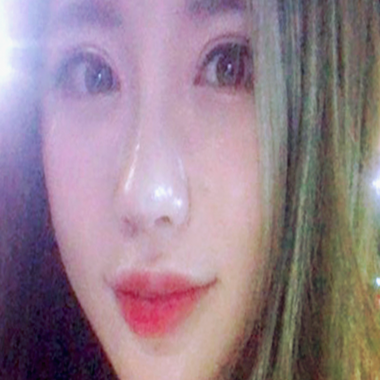  쌍꺼풀재수술가격 / 잘하는 곳 찾는다면?