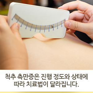  척추 측만증은 진행 정도와 상태에 따라 치료법이 달라집니다. (척추옆굽음증 치료방법)