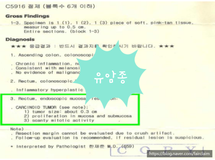  [보험금 지급 사례] "직장 유암종(Rectum carcinoid)" 암 진단비 전액 지급 받은 사례(서울 공정한손해사정)
