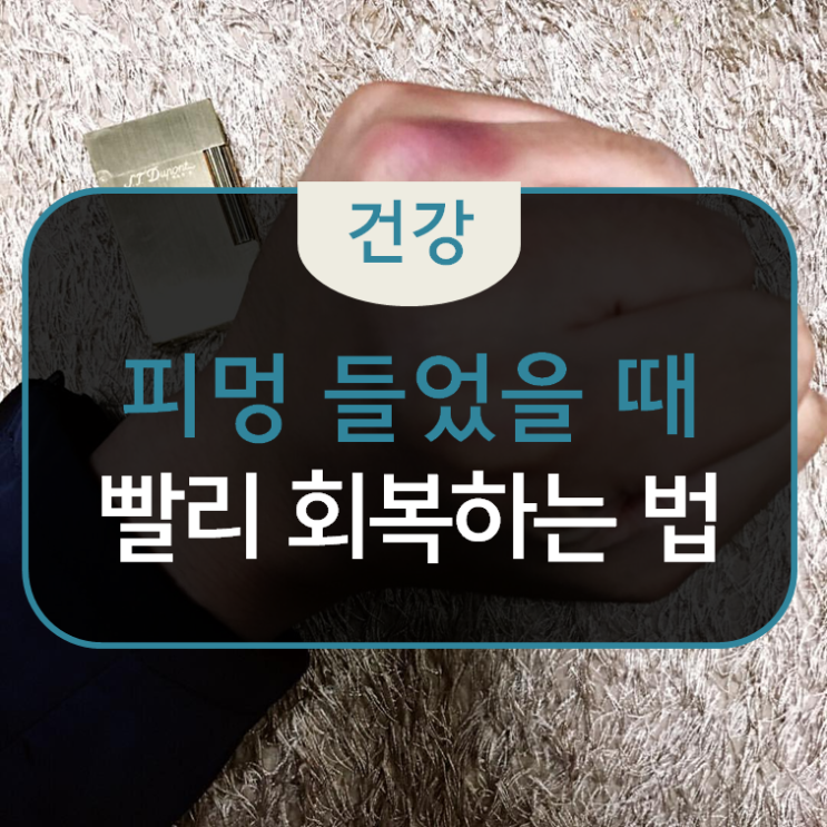  피멍들었을 때 빨리 나을 수밖에 없는 3가지 방법