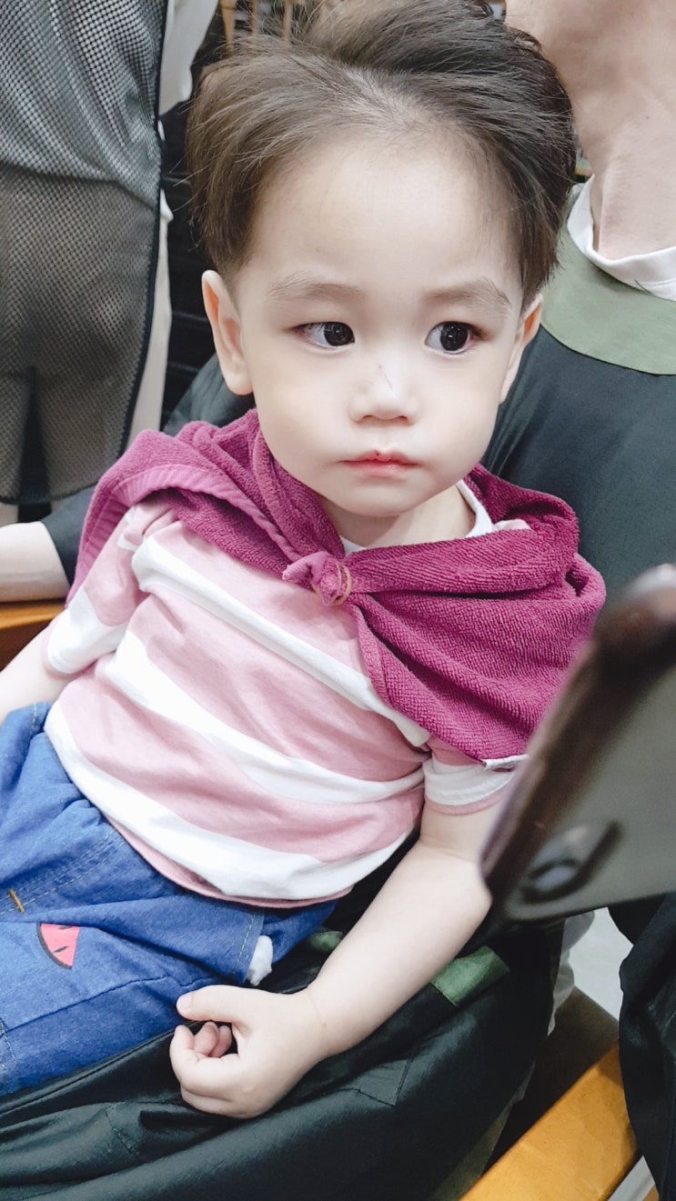  22개월 아기, 수족구가 남기고 간 흔적 and 수족구 증상
