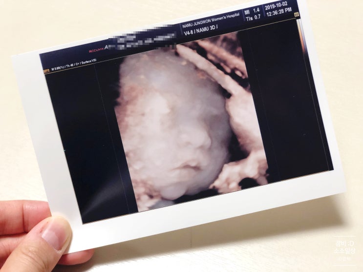 임신28주 입체초음파, 임당재검통과, 킨텍스 베이비페어 카시트(콩코드)구입 / 임신후기 8개월 증상
