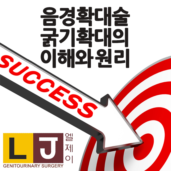  음경확대술 굵기확대의 이해와 원리
