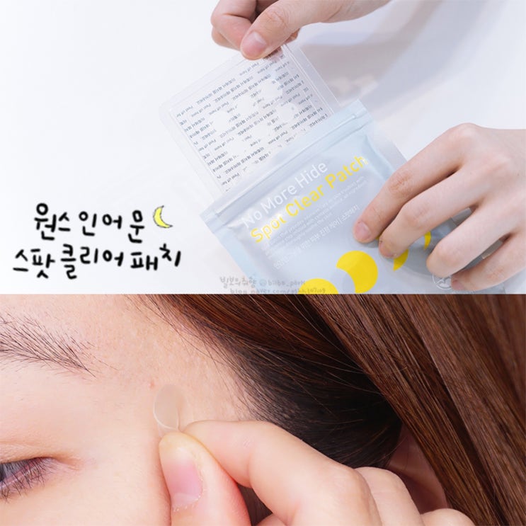  원스인어문 트러블패치: 불긋 불긋 짜증날때 집중케어용 여드름패치