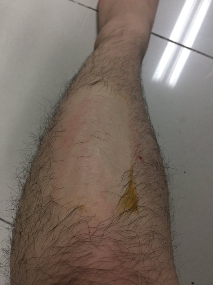  천연 제모제 페리샤 2인1 롤온 바디슈가로 다리왁싱 셀프제모