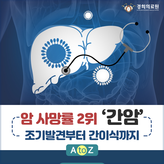  암 사망률 2위 ‘간암’ 조기발견부터 간이식까지 A to Z / 소화기내과 심재준 교수, 간‧담도‧췌장외과 김범수 교수