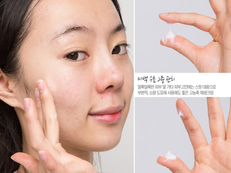  피부재생크림 붉은피부 옅어지넴 호호ㅎ
