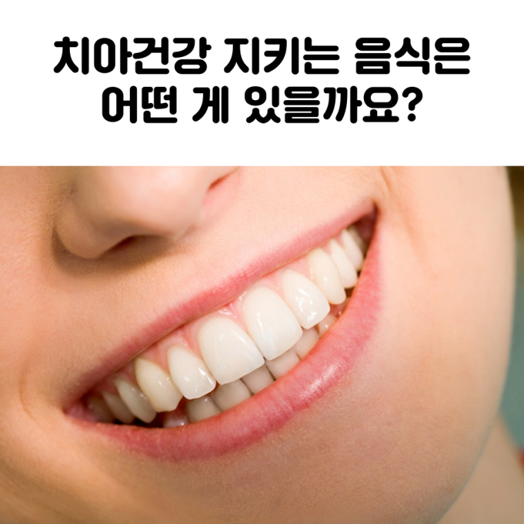  대학로 이물비치과 치아건강 지키는 음식은 어떤 게 있을까요?