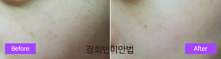  얼굴미백팩 하얀피부를 원하신다면 이게최고!