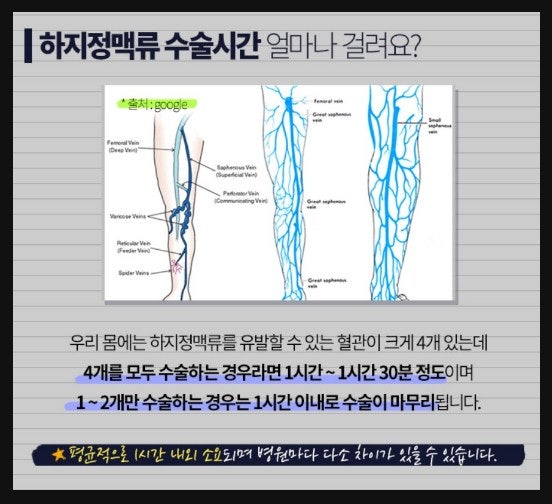 하지정맥류 원인 과거와 다른 부분은 명의와 함께 알아보세요! 14