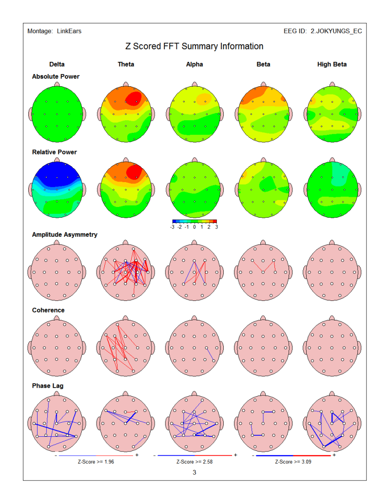 뉴로가이드 표준 뇌파 데이터베이스 / EEG, QEEG 분석시스템 / NeuroGuide : 네이버 블로그