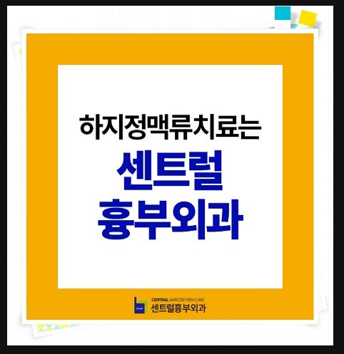 하지정맥류 원인 과거와 다른 부분은 명의와 함께 알아보세요! 6