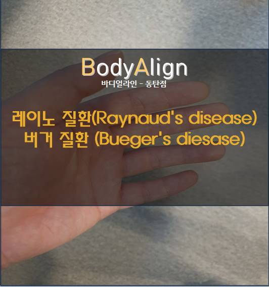  레이노병(Raynaud's disease)와 버거 질환(Bueger's disease)의 차이점