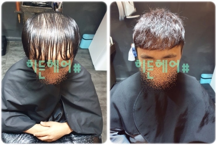  인천 대표 남자 탈모 M자 이마 커버 전문 미용실