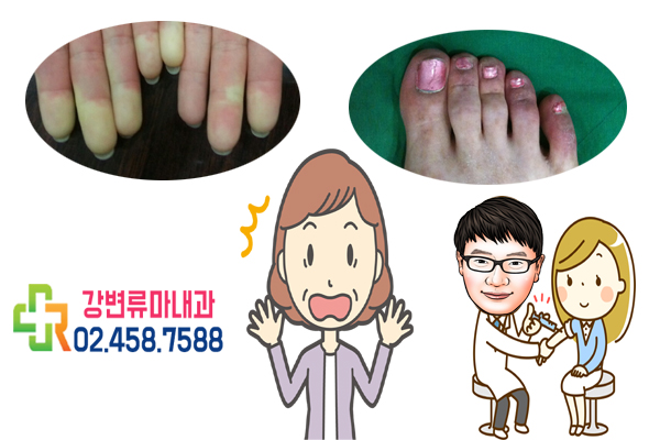  손발이 차가워요 레이노병 알고 계시나요?