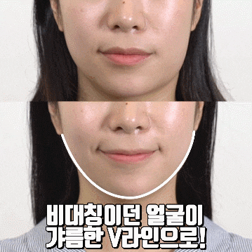  턱선 만들기 그리고 무로 코코넨네 밴드로 잠버릇 고치기