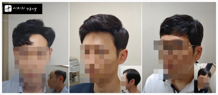  "가발은 얼마나 쓸 수 있을까?" 가발수명을 알아봅시다