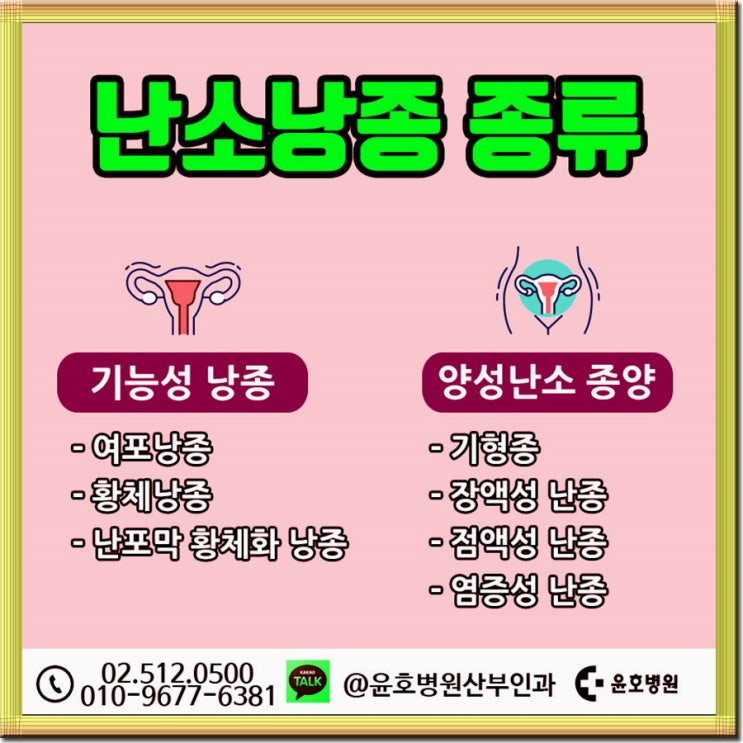  난소낭종원인 대비를 잘해요