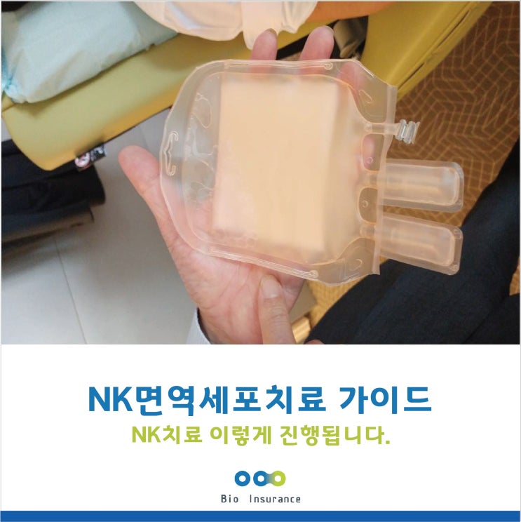  NK면역세포치료 가이드