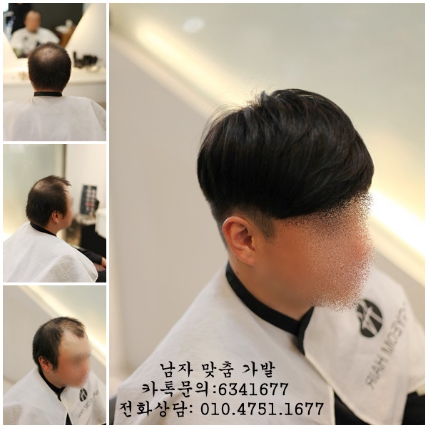  대구 가발 고정식가발 쓰고 탈모 고민 해결했어요