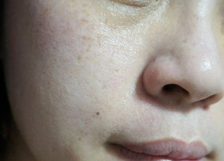  갈바닉 마사지기 2배효과(브라라인V보톡스앰플)사용해봄