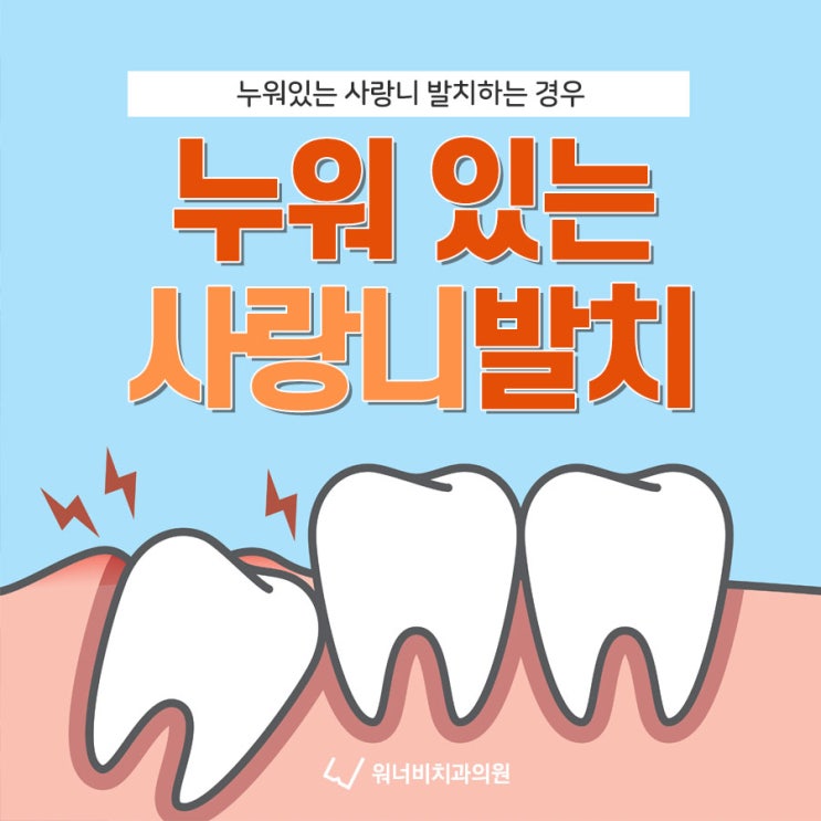  부산사랑니발치치과 누워 있는 사랑니 발치하는 경우